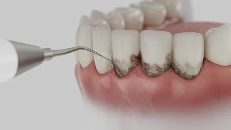 Trusted Teeth Cleaning And Checkup service in Lake Holiday, VA - Dentist Open Now
